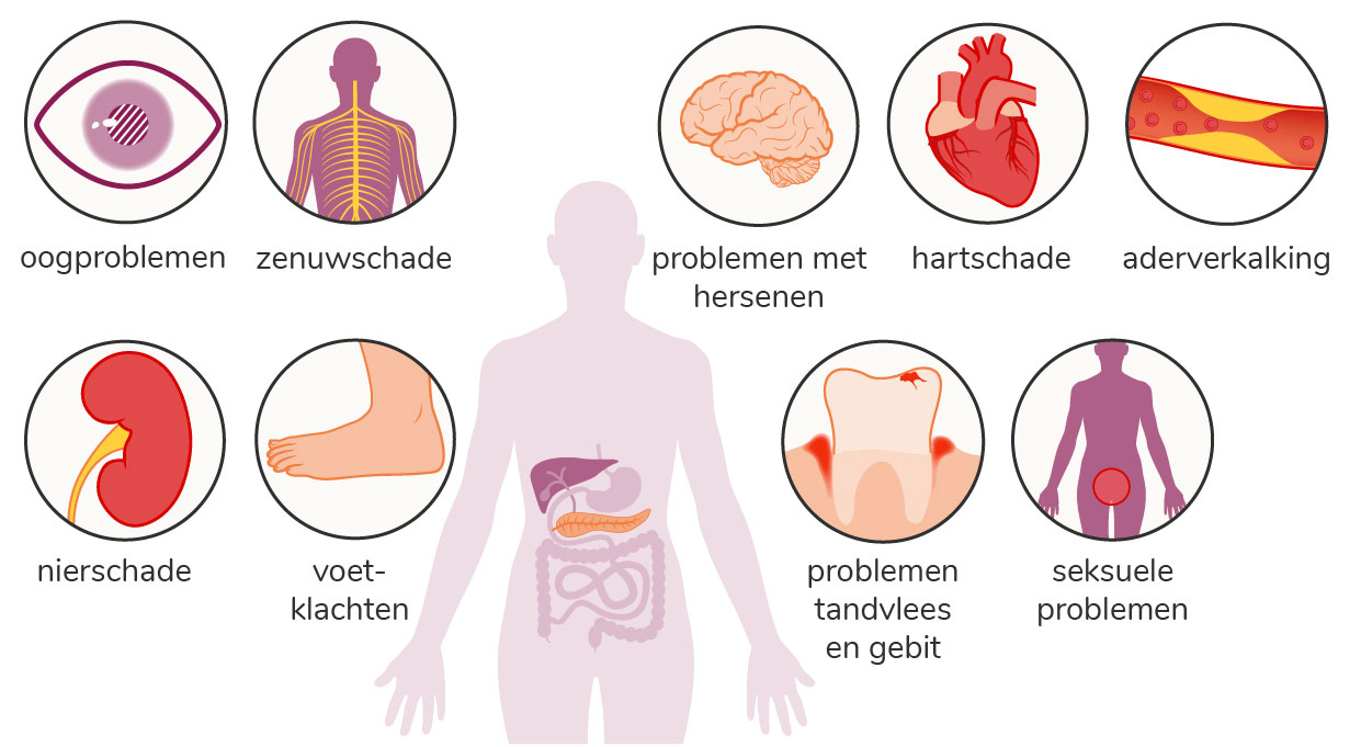 Aandoeningen die vaak voorkomen bij diabetes heten complicaties van diabetes.