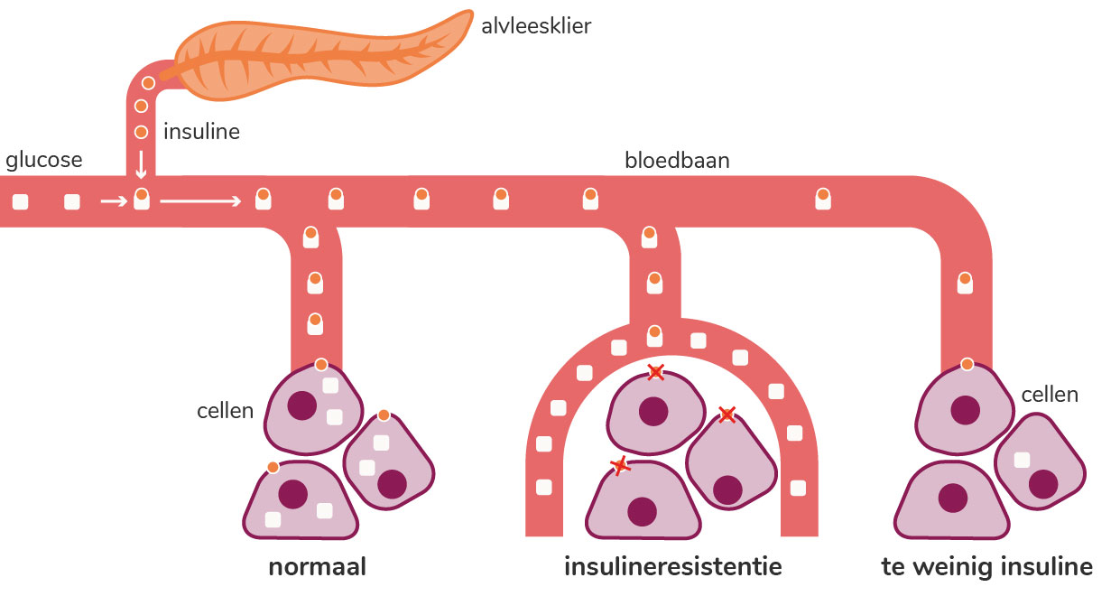 Bij diabetes type 2 reageert het lichaam niet meer goed op insuline. Je bent er minder gevoelig voor. Dit heet insulineresistentie.