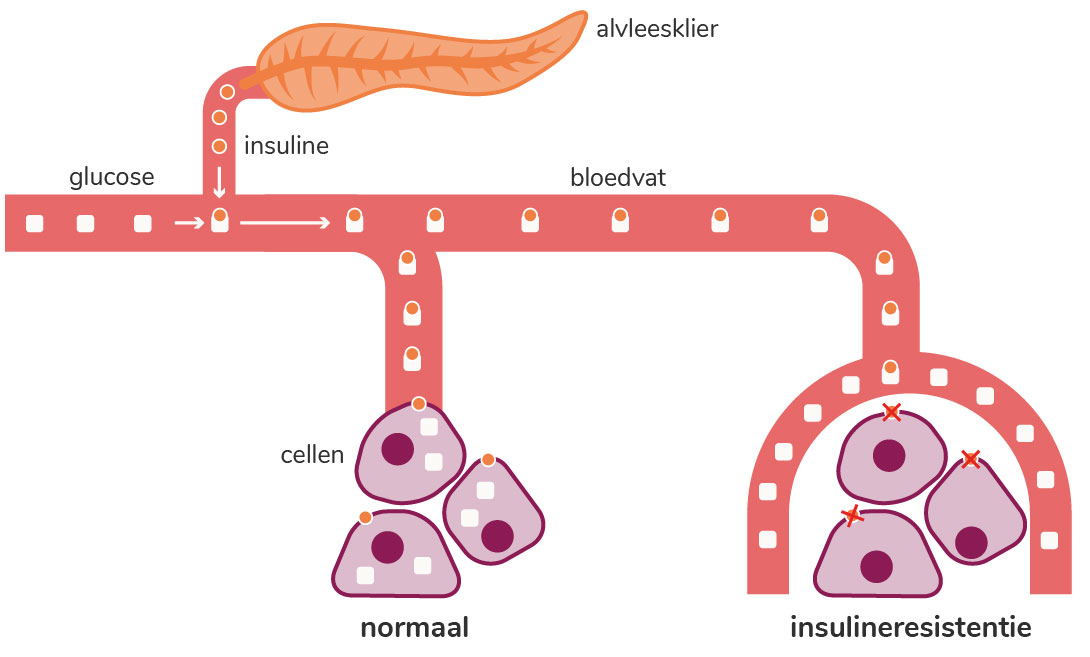 illustratie van wat in je lichaam gebeurt bij insulineresistentie