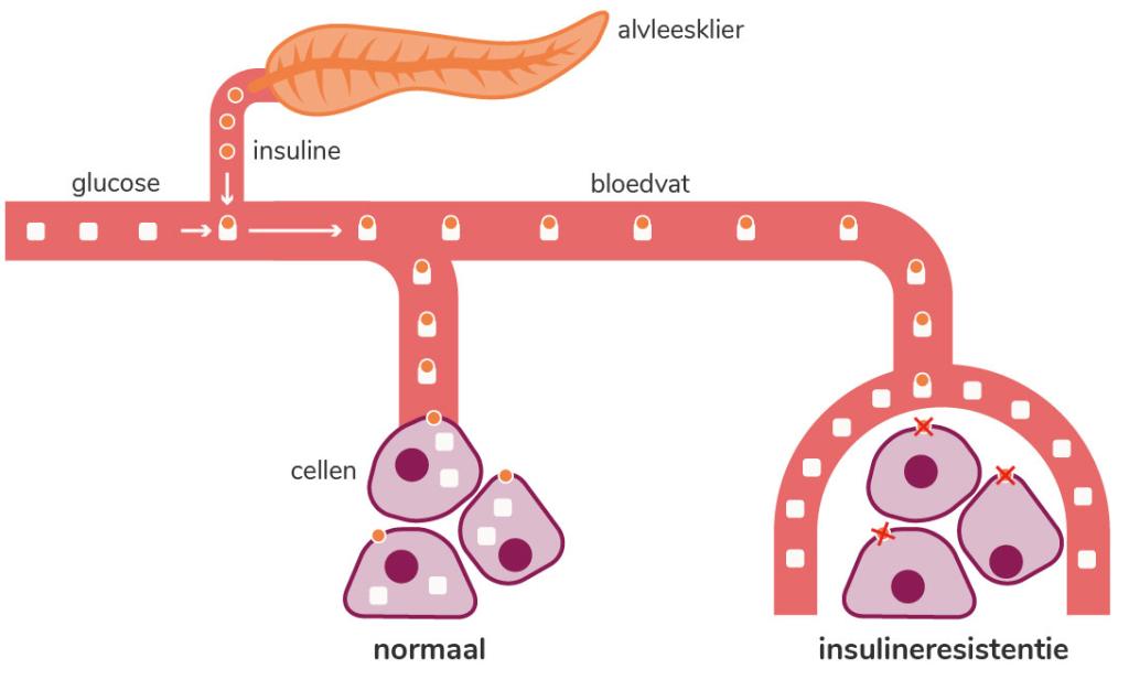 Insulineresistentie is erg ongezond. Je lichaam vindt het steeds moeilijker om glucose uit je bloed naar de cellen te brengen.