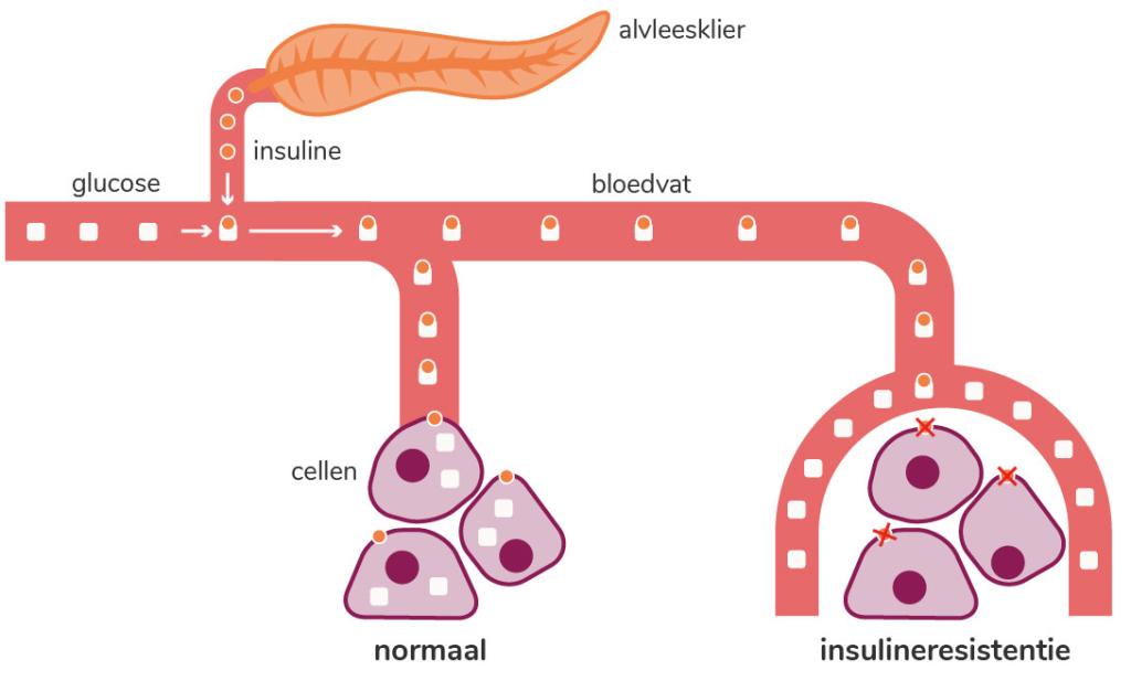 illustratie van wat in je lichaam gebeurt bij insulineresistentie