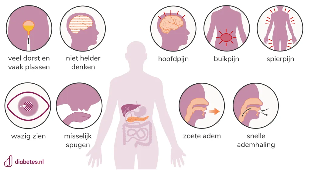 Plaatje met de belangrijkste kenmerken van ketoacidose bij diabetes