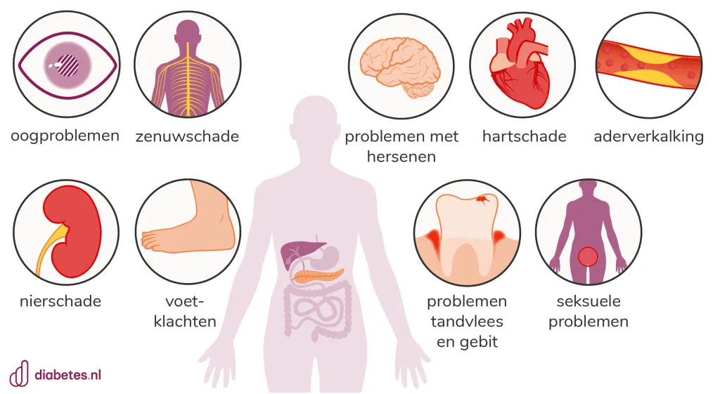 Plaatje met aandoeningen die vaak voorkomen bij diabetes. Deze heten complicaties van diabetes.