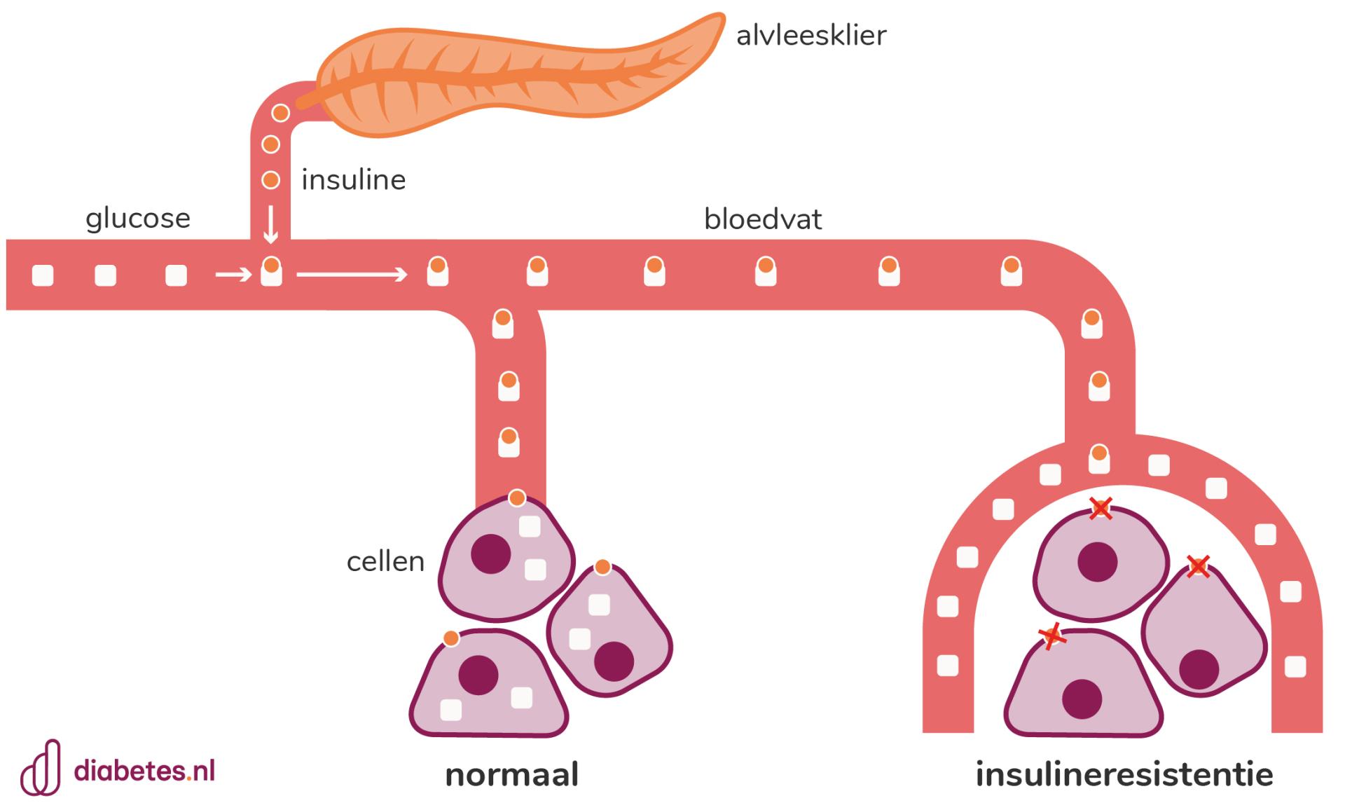 Hoe zijn de bloedglucosewaarden bij diabetes type 2? - diabetes.nl